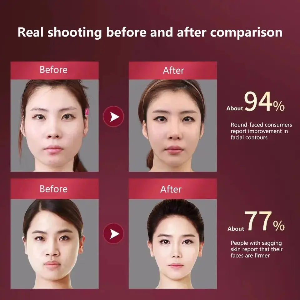 Electric Facial Lifting Massager Device