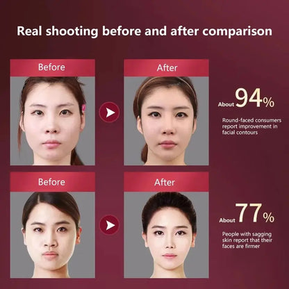 Electric Facial Lifting Massager Device